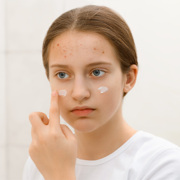 face of a teenage girl with pimples